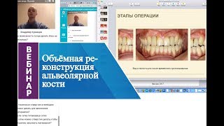 Вебинар «Объёмная реконструкция альвеолярной кости».