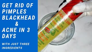 HOW TO GET RID OF PIMPLES  BLACKHEAD AND ANCE WITH JUST 3 INGREDIENTS | FACE TREATMENT |OLAJUMOKE OJ