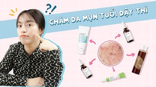 SEOULISTA | ROUTINE CHĂM DA MỤN TUỔI DẬY THÌ ĐÚNG CÁCH