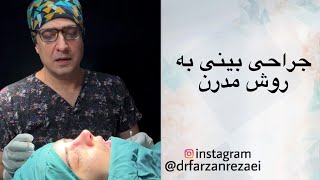 جراحی بینی به روش مدرن