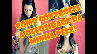 Como Controlei a Oleosidade da Minha Pele