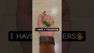 I have 4 fingers😜 #challenge #hand #finger #funny #duet #shorts #viralvideo