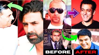 Bollywood Celebrities Who Transformed Their Look with Hair Transplants