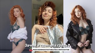 Зачем я сделала грудь? Моя маммопластика без имплантов🍒