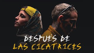 Valen Etchegoyen & Coco Swing - Después de las Cicatrices (Video Oficial)