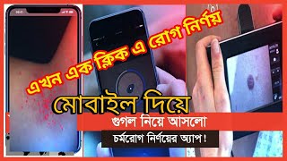 এখন আর ডাক্তার কাছে যাওয়া লাগবে না।একটি App এ সব রোগ এর চিকিৎসা হবে