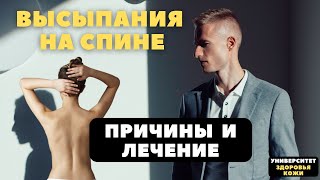 Высыпания на спине - причины и лечение