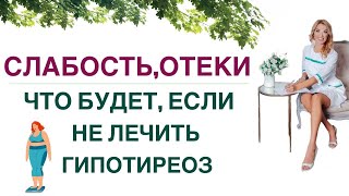 💊 СЛАБОСТЬ❓СОНЛИВОСТЬ ❓ НАБОР ВЕСА❓ГИПОТИРЕОЗ, КАК ПРАВИЛЬНО ЛЕЧИТЬ? Врач эндокринолог Ольга Павлова