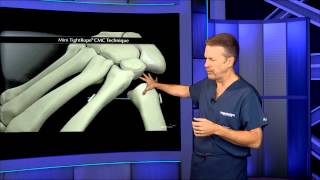 TMC Joint Replacement Surgery