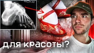 Лотосовая ножка | Китайцы делали сами себе обрезание? | Пересадка головы | РазМИШления.