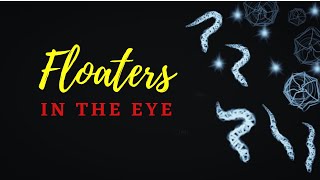 #floaters | What are eye floaters?