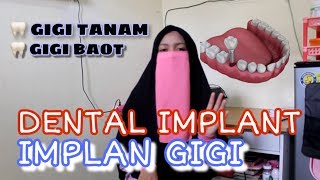 IMPLAN GIGI | Danti Narulita