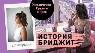 Красивая история Бриджит об увеличение груди в Корее