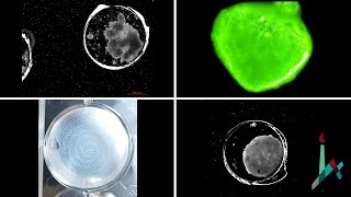 Tiny, Multichambered Human Heart Model Could Transform Cardiovascular Research and Drug Evaluation