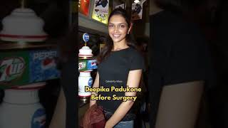 Bollywood Actresses With Plastic Surgery #shorts #bollywood #viral #bollywoodactresses