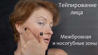 Тейпирование лица. Межбровная и носогубные зоны.