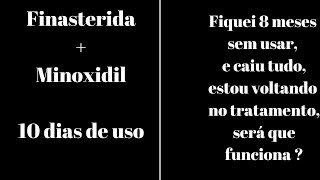 Finasterida e minoxidil 10 dias de tratamento - Fiquei 9 meses sem usar e olha como ficou