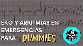 EKG y arritmias para DUMMIES