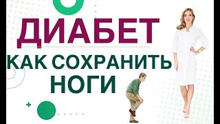 💊 Сахарный диабет. Осложнения. Диабет стопа, как сохранить ноги? Врач эндокринолог Ольга Павлова.