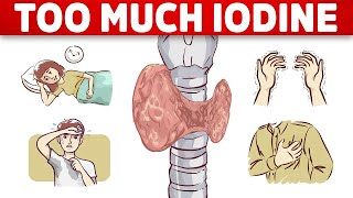 The #1 Sign of Iodine Overload (TOXICITY)