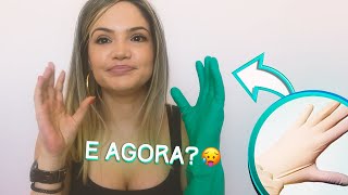 EU TENHO ALERGIA À LÁTEX!