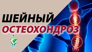 Как избавиться от остеохондроза без хлопот.  Академия Целителей.