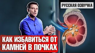 Камни в почках: Как избавиться? (русская озвучка)