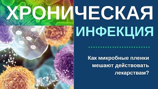 Как избавиться от хронической инфекции, когда не помогли обычные средства?