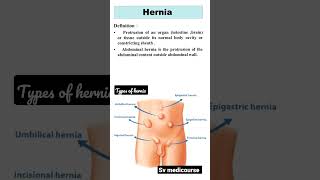 Types of hernia #disease #anatomy #surgeryrecovery #structure #svmedicourse