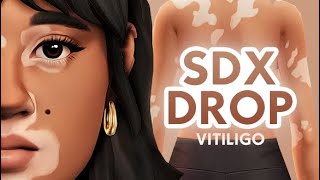 New SDX Drop Gives Us FREE Vitiligo SKIN DETAILS 🤎