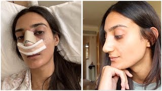 Dealing with Post Surgery Depression & Reading my Hate Comments