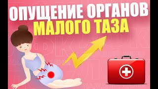 Упражнения при опущении органов малого таза | ЛФК