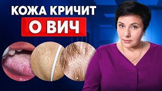 Как проявляется ВИЧ на коже? ПЕРВЫЕ ОПАСНЫЕ СИМПТОМЫ