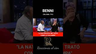 Benni en programa Tal Cual #benni #viral #humor #humorchileno #chile #reaccionesalcien