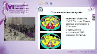 Степанова Александра Михайловна - Роль нутритивной поддержки в реабилитации онкологических больных