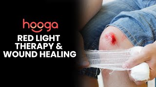 How Red Light Therapy Can Help Heal Cuts, Scrapes, and Wounds Faster!