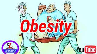 Obesity / Causes of obesity / How to avoid from obesity/ fatty  person / Treatment of obesity