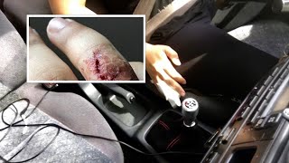 Driving a Manual Car with Broken Finger (CAR VLOG)