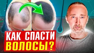 Причины выпадения волос! Как отрастить новые волосы?