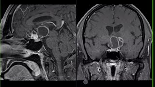 neuroradiology masterclass P7