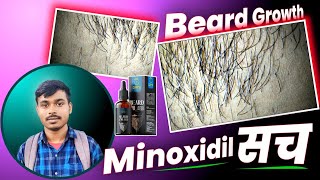 Minoxidil 5% How to Beard Growth Only 7 Day's :⁠-⁠) Quick Hairstyle || Ep :- 90 #growth