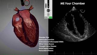 Transesophageal Echocardiography (TEE) Imaging