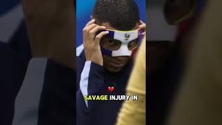 Mbappe broke his nose