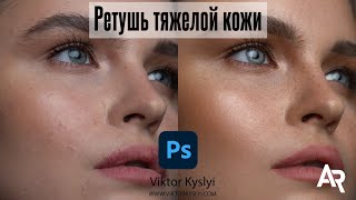 Как ретушировать плохую кожу ? Ретушь сложной кожи в Фотошоп Частотное разложение. Частотка