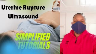 Uterine Rupture on ultrasound scan