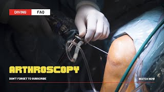 Arthroscopy