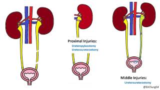 Genitourinary Injuries