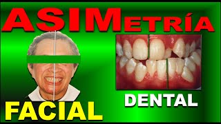 ASIMETRIAS FACIALES Y DENTALES (DIAGNOSTICO Y TRATAMIENTO EN ORTODONCIA)