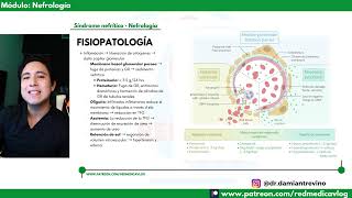 Síndrome nefrítico #ENARM | 🩺Dr. Treviño