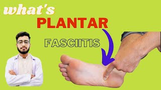 Plantar Fasciitis: Causes, Symptoms,  Risk Factors ,Diagnosis and Treatment